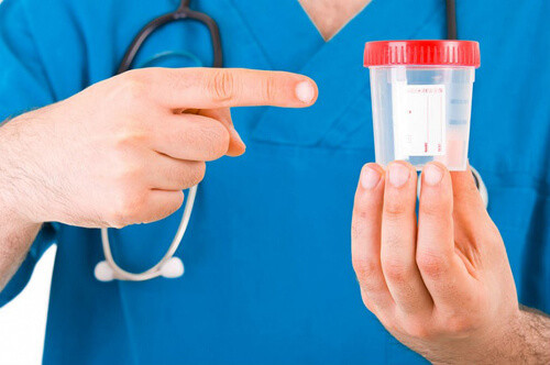 Подготовка к сбору и сдаче анализов мочи и кала