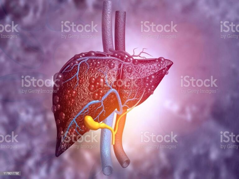 Профилактика вирусных гепатитов